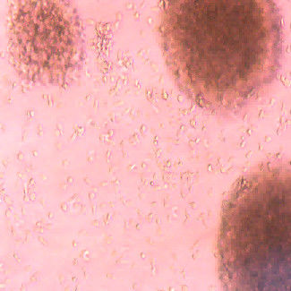 Good price Prevent Treat Tumors Immune Cells Improve Sub Health Conditions Types Of Immune Cells online